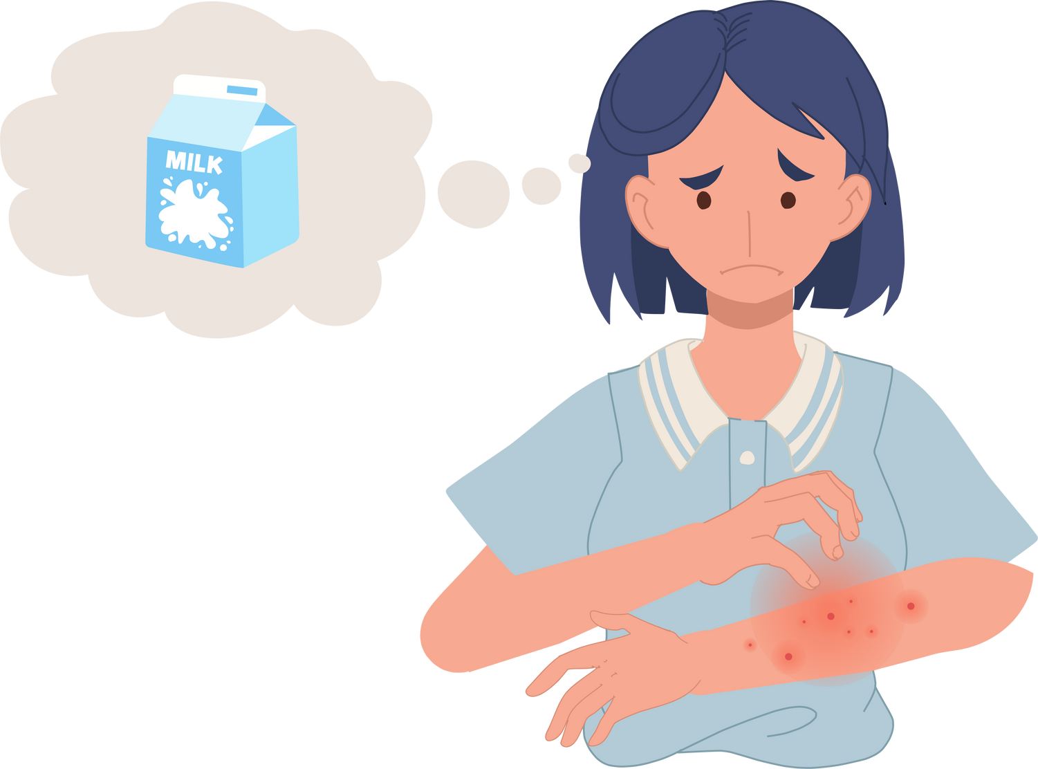 Food Allergy. lactose Allergy Reaction. Skin Rash in Woman Due to Milk